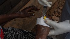 Mpox: les premiers vaccins arrivés en RDC, épicentre de l'épidémie