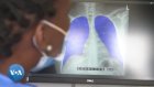 Afrique du Sud : Un vaccin révolutionnaire contre la tuberculose pulmonaire en phase de test
