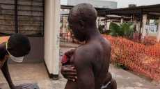 Le silence du gouvernement burundais sur l'épidémie de mpox indigne